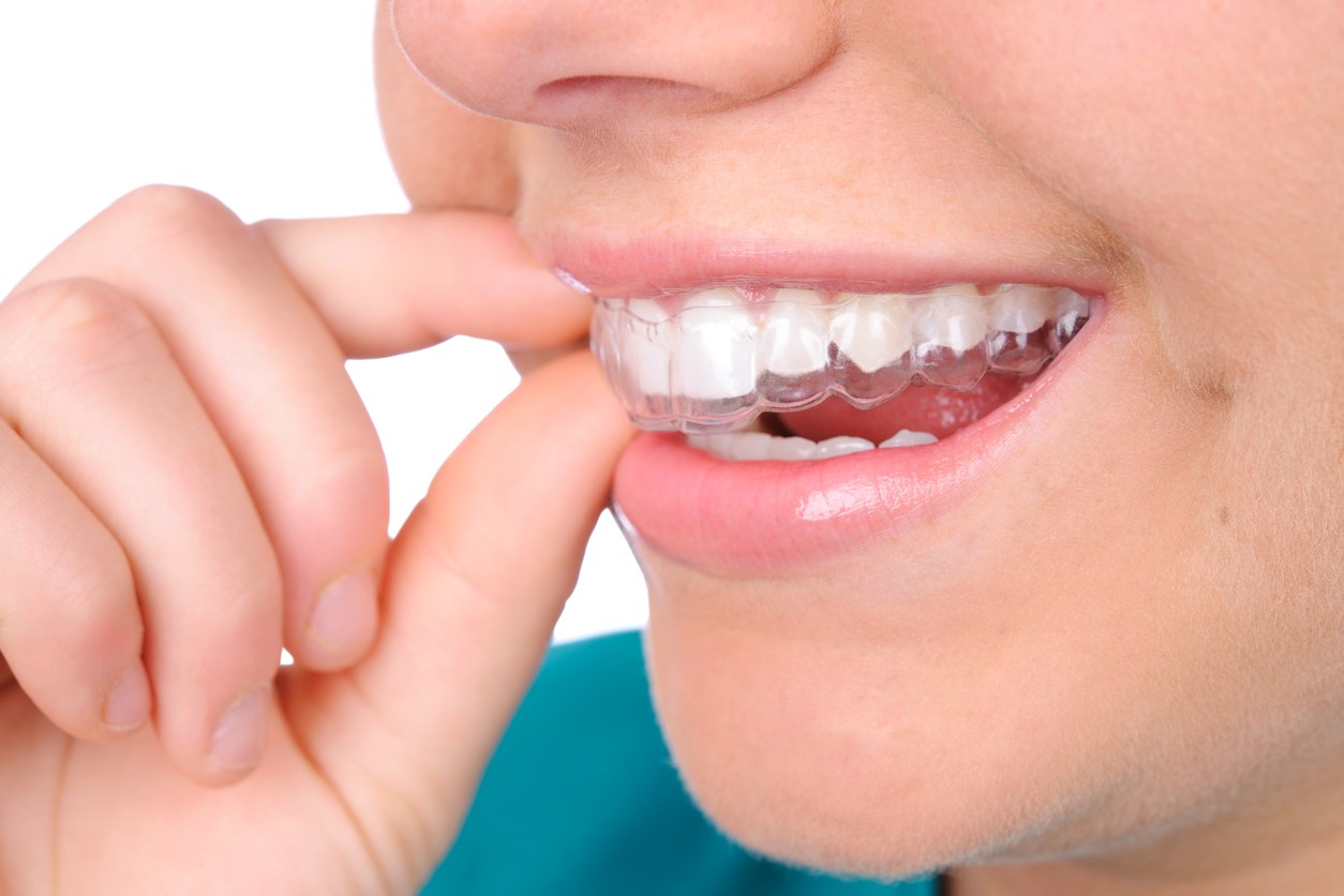 L’orthodontie en 5 questions