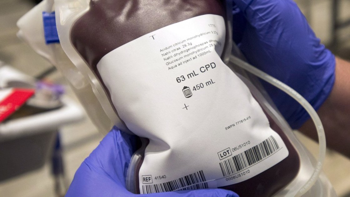 Diminution des réactions à la suite de transfusions de produits sanguins