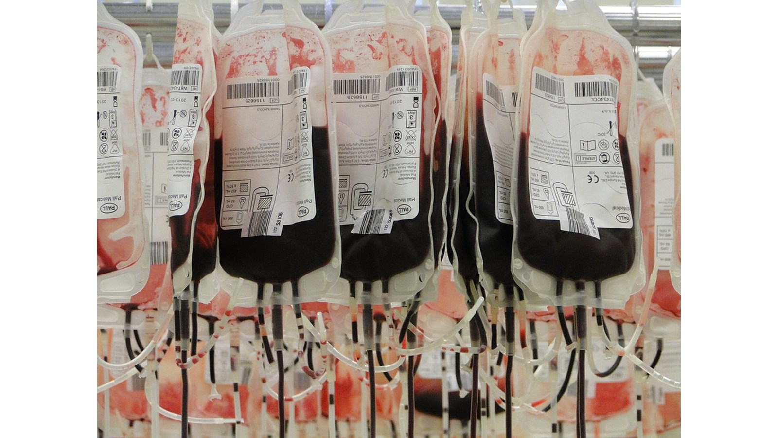 On estime que près d’une personne sur sept au Québec a reçu un don de sang. Annuellement, c’est 80 000 personnes qui reçoivent des produits sanguins au Québec.