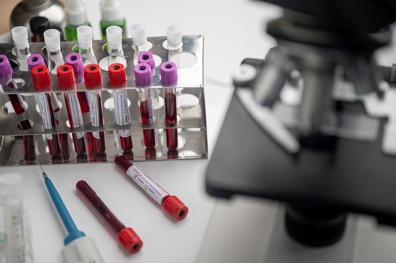 "LIAISON" de DiaSorin est le premier test de dépistage sérologique (recherche d'anticorps liés au coronavirus dans le sang) de la COVID-19 développé et autorisé par Santé Canada, ce mercredi 13 mai.