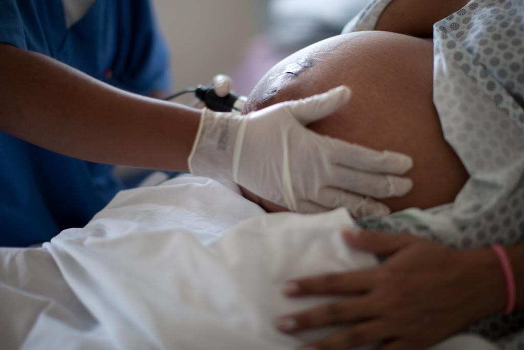 Les hormones naturelles des femmes ont un effet protecteur sur leur cerveau