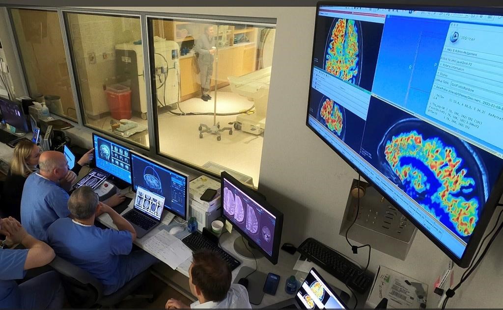 Troubles neurocognitifs: hausse de 145 % des cas au Québec d'ici 2050