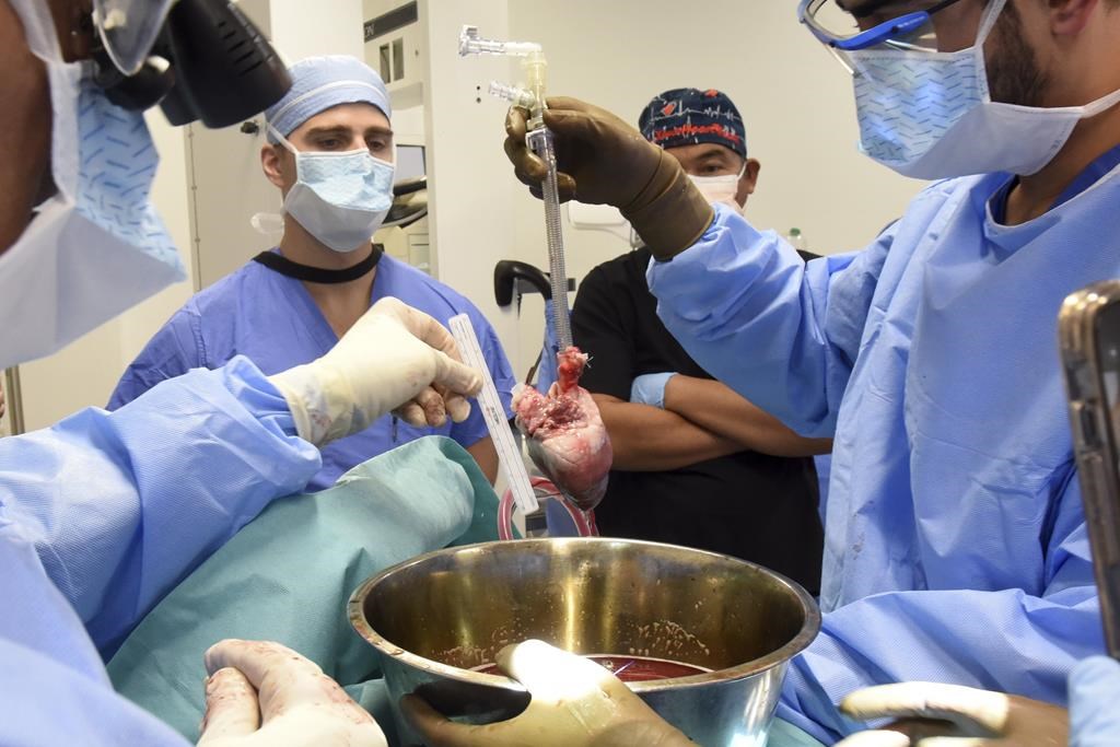 Dons d'organes: Transplant Québec veut un projet de loi pour qu'il y en ait davantage