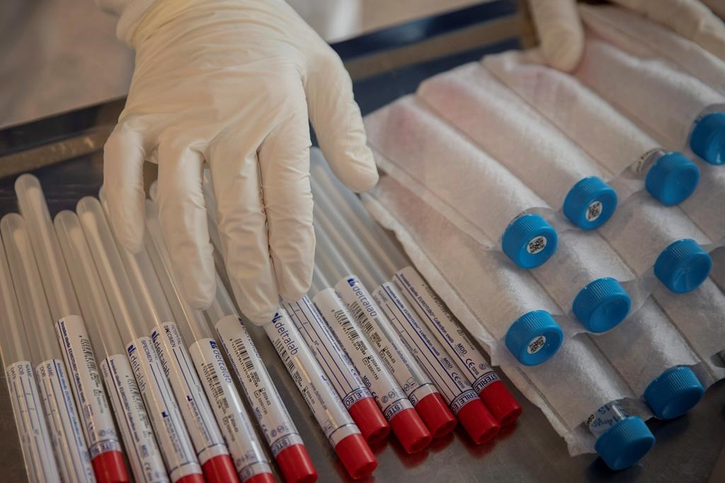 Une coalition veut décloisonner le dépistage du VIH au Québec