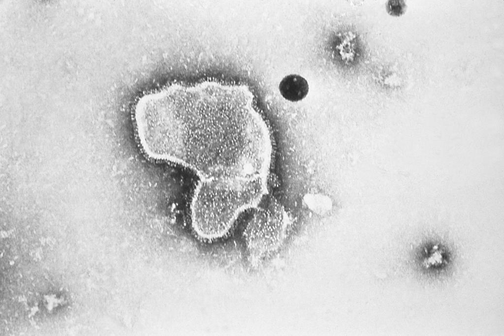Pfizer Canada travaille sur un vaccin contre le virus respiratoire syncytial