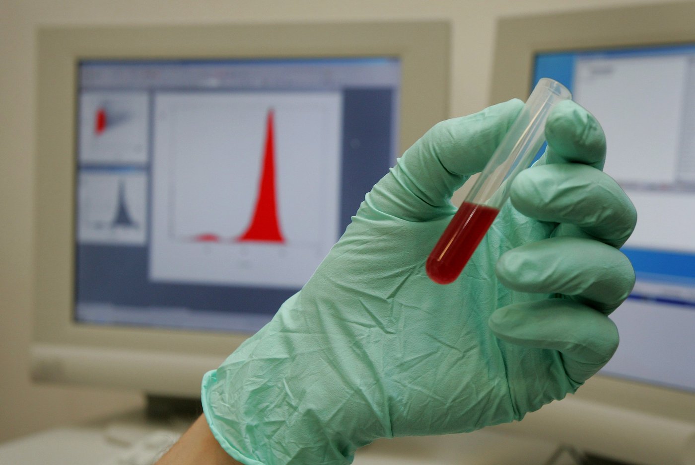 Les techniciens du Laboratoire de l'INSPQ approuvent l'entente de principe
