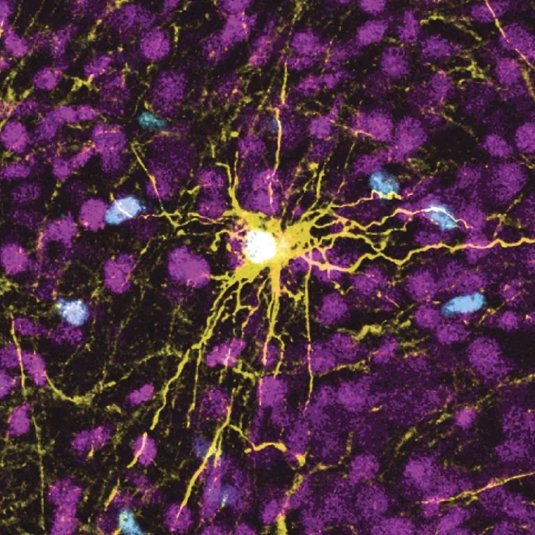 Maladie d'Alzheimer: le rôle du microbiote se précise