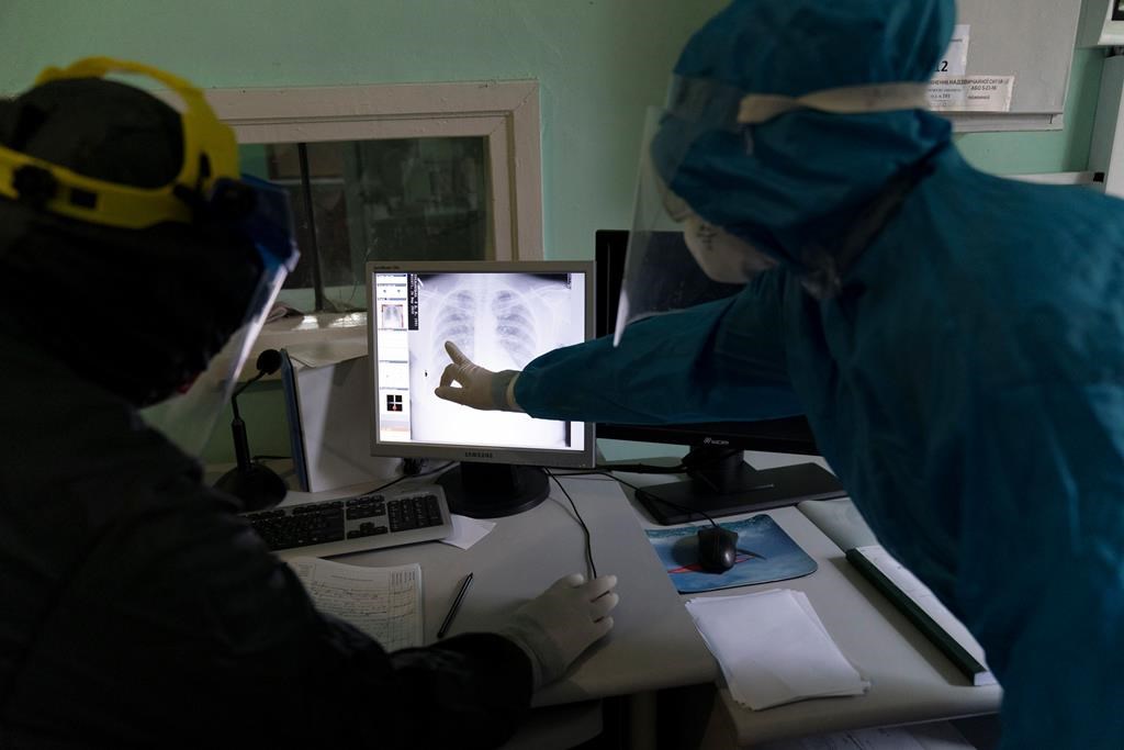 Nouvel espoir dans la lutte au cancer du poumon