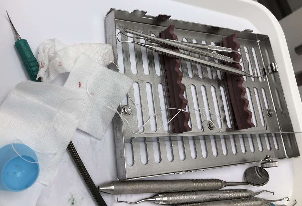 Soins dentaires: les provinces les plus généreuses en reçoivent moins du fédéral
