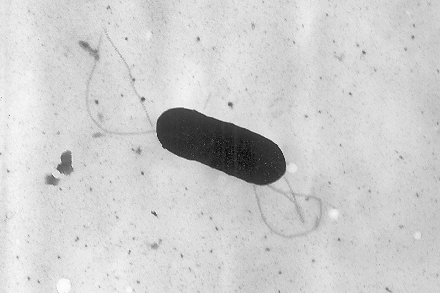 Lait végétal: de nouvelles infections par la bactérie Listeria signalées au Canada