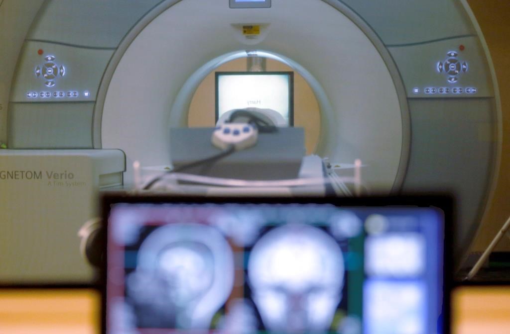 Parkinson: pas besoin de reconnecter les neurones?