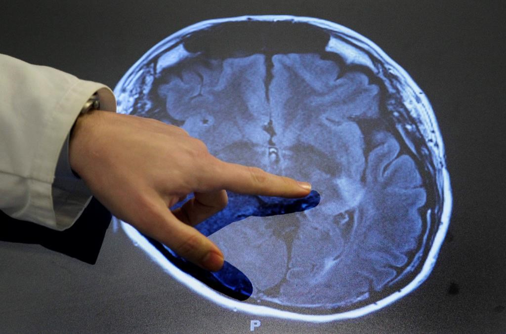 Des chercheurs du Québec inventent une technologie pour crypter des données médicales