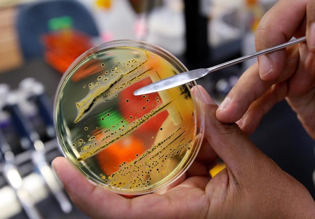 La santé publique du Canada enquête sur une éclosion de salmonelle à travers le pays