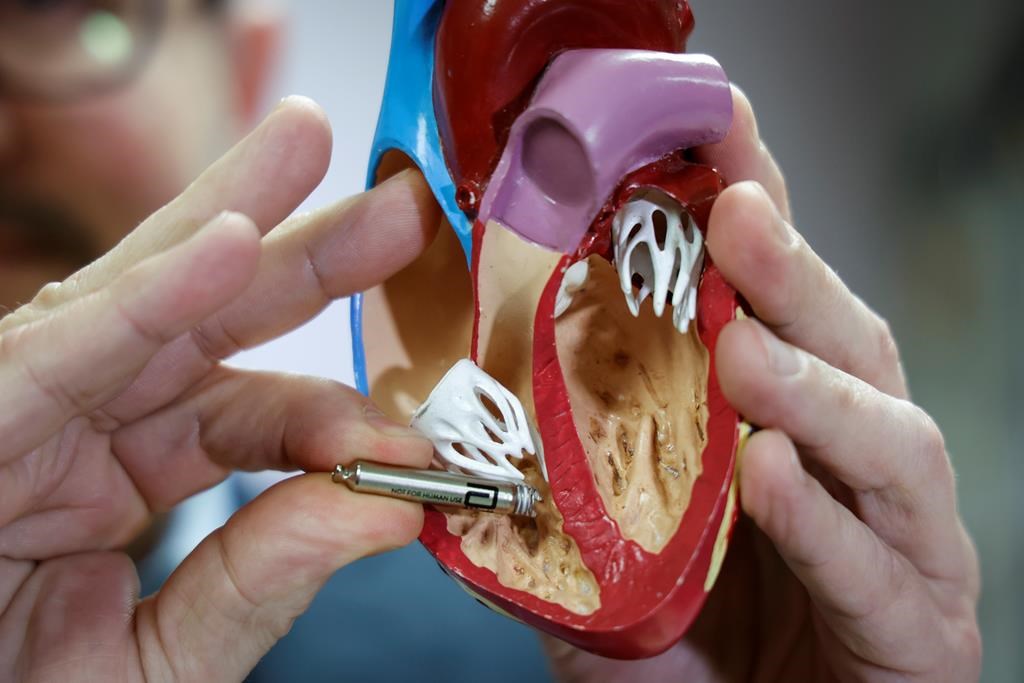 Canada: plus d'arrêts cardiaques que ce qu'estimé et 1 personne sur 10 y survit