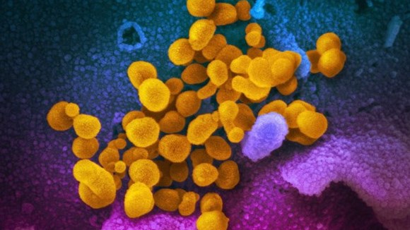 Les ultrasons pourraient être utilisés pour combattre les virus