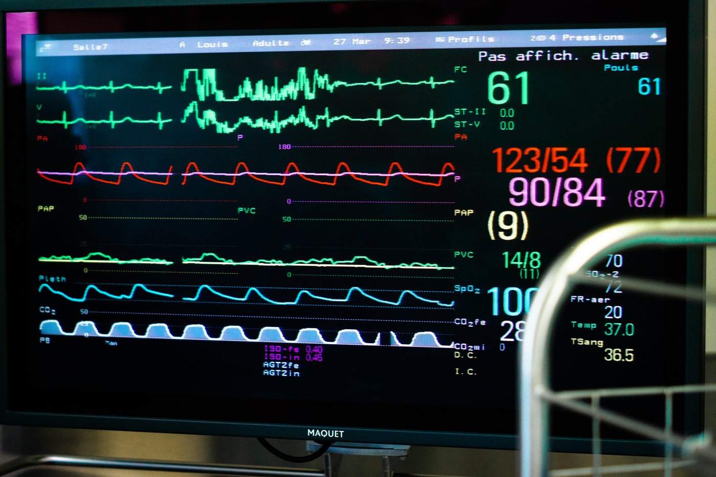 ICM: un nouveau traitement de l'arythmie permet de soigner deux fois plus de patients