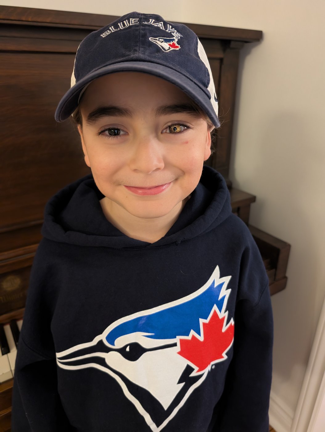 Un enfant montre son amour pour les Blue Jays avec sa prothèse oculaire
