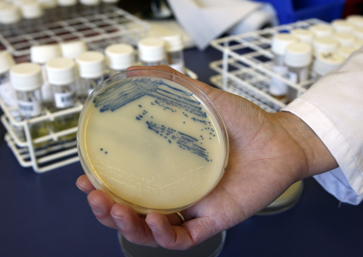 Changement majeur dans le traitement du staphylococcus aureus