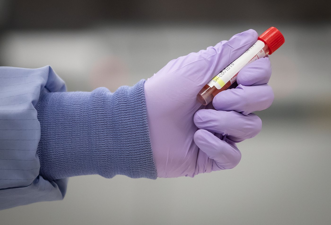Grève des professionnels au Laboratoire de santé publique du Québec