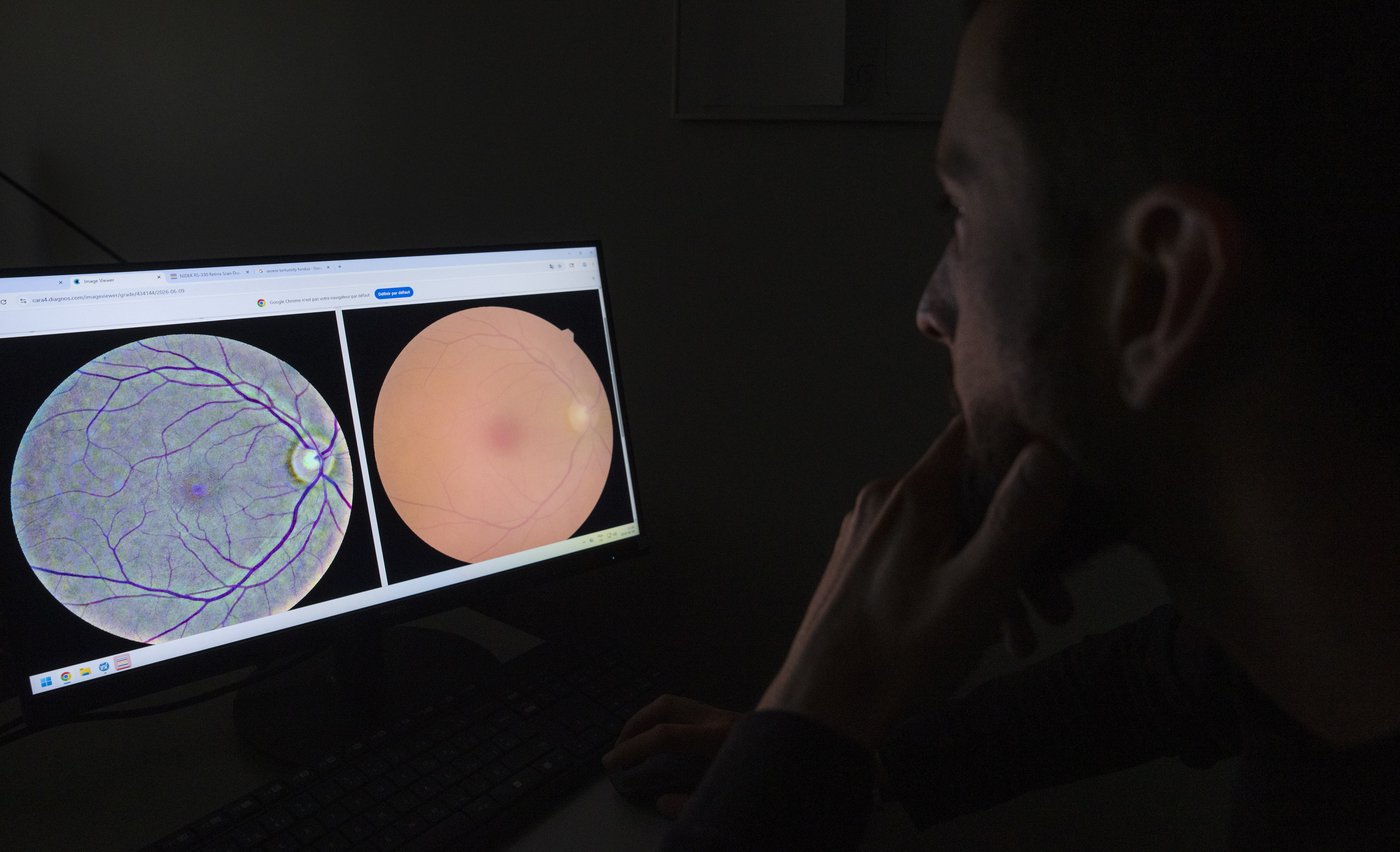 Une analyse de la rétine pourrait permettre de dépister une centaine de maladies