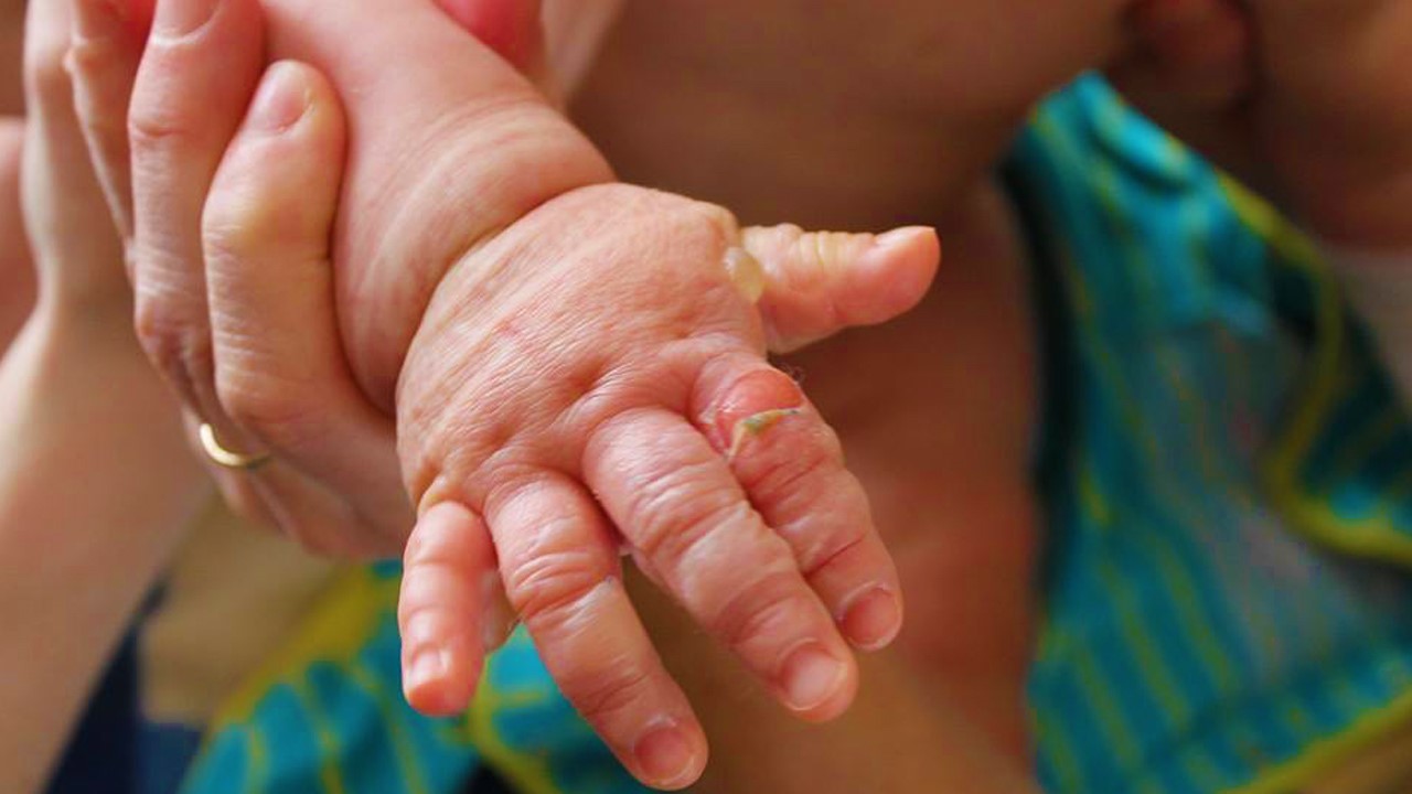Photo publié sur Facebook par la mère de l'enfant