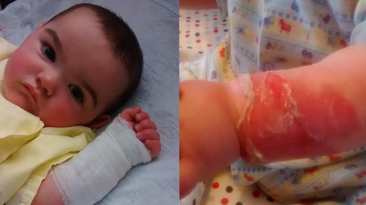  Photos publiés sur Facebook par la mère de l'enfant