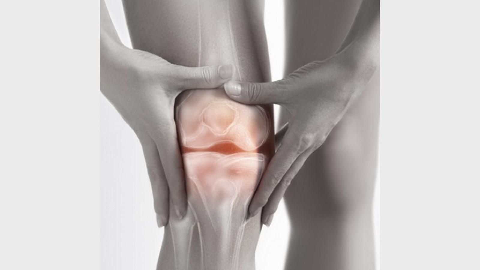 Conseils physio pour traiter l’arthrose