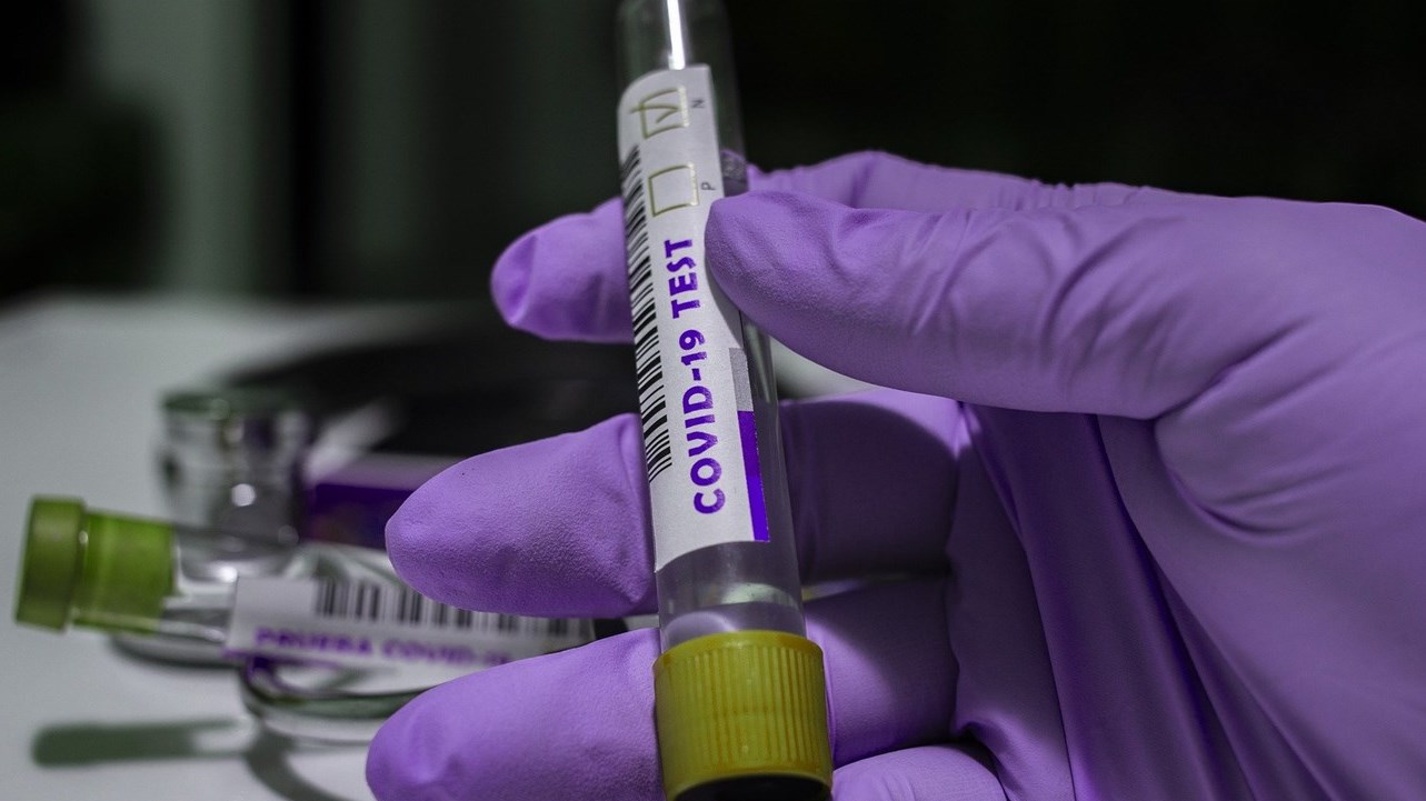 COVID-19 : quatre nouveaux tests positifs en Chaudière-Appalaches