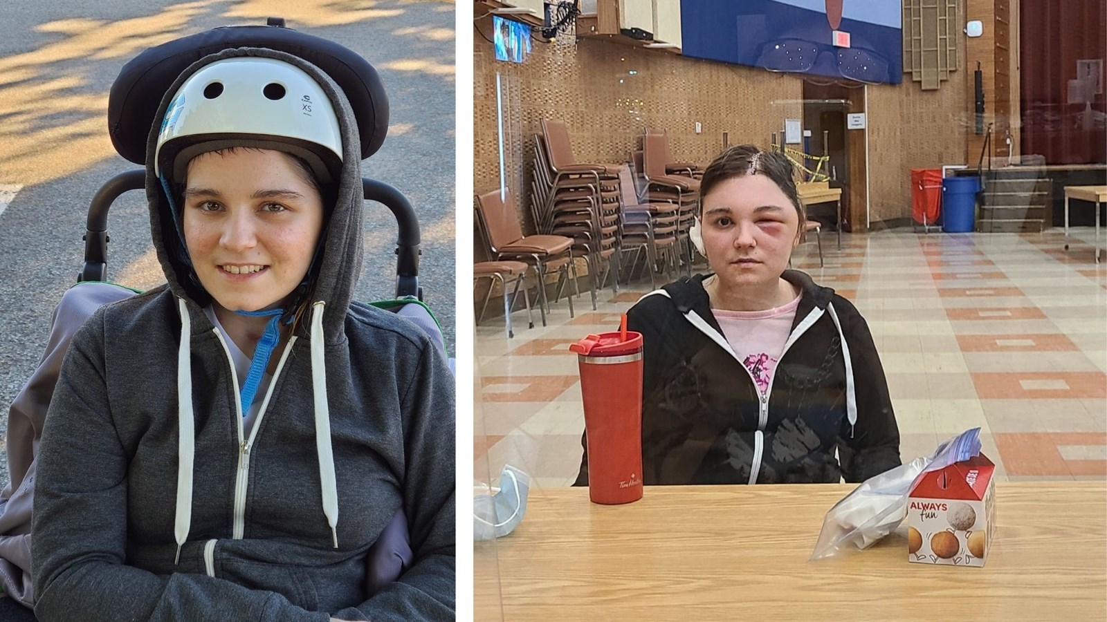 Une collecte de fonds pour aider la famille de Lydia à adapter leur maison