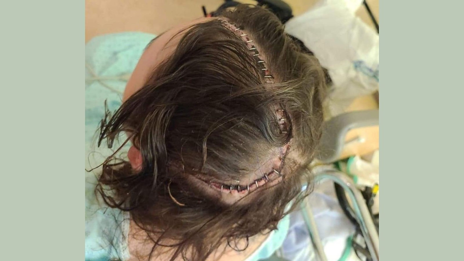 Une collecte de fonds pour aider la famille de Lydia à adapter leur maison