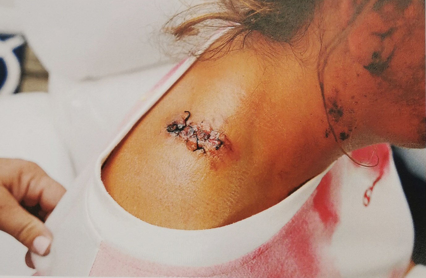 Les blessures de l'agente Catherine Giroux